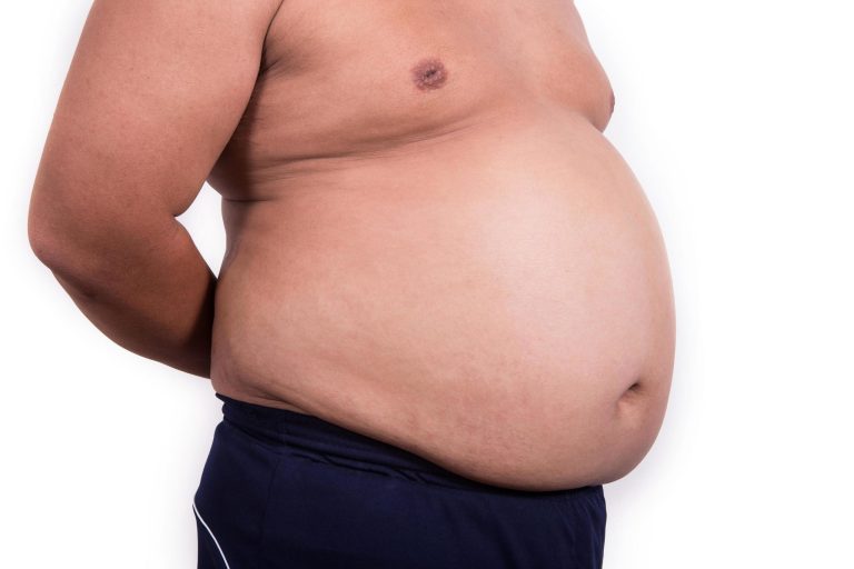 fat-man-with-a-big-belly-diet-free-photo